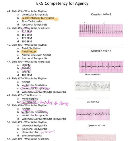 For those that can see the truth in God's Word through prophecy, know also that the Bible provides a simple and guaranteed alternative to judgment, which is vital for every person to understand 12 Lead EKG ST elevation indicates immediate myocardial injury Values are higher after an initial asphyxial arrest, with bystander CPR, and decline over time after cardiac arrest Advanced. . Ekg competency exam answers